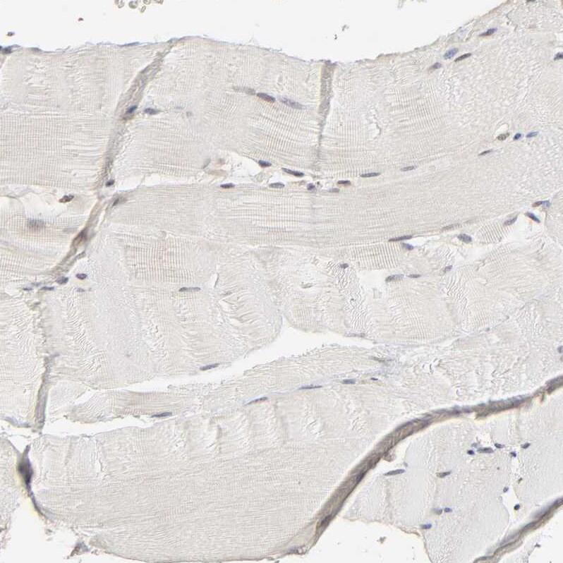 SCFD1 Antibody - BSA Free Immunohistochemistry-Paraffin: SCFD1 Antibody - BSA Free [NBP1-88418]