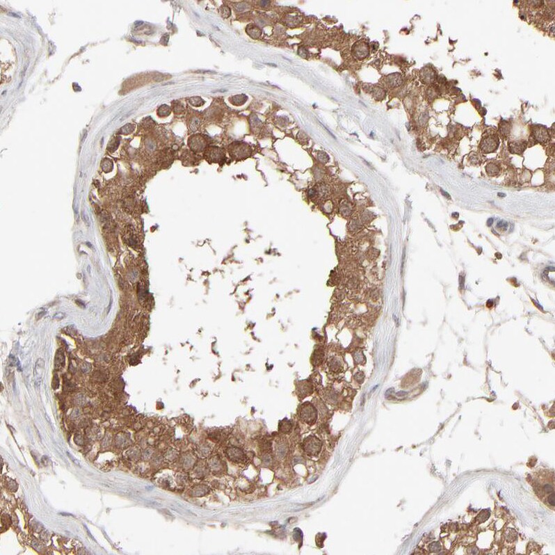 SCFD1 Antibody - BSA Free Immunohistochemistry-Paraffin: SCFD1 Antibody - BSA Free [NBP1-88418]