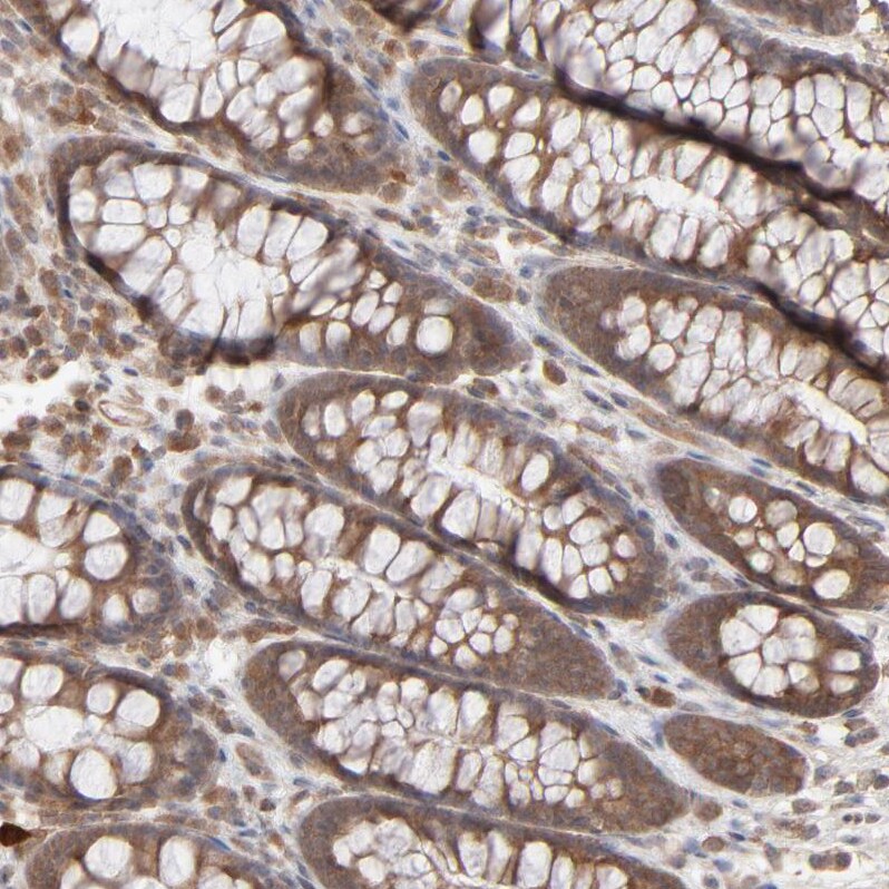 SCFD1 Antibody - BSA Free Immunohistochemistry-Paraffin: SCFD1 Antibody - BSA Free [NBP1-88418]