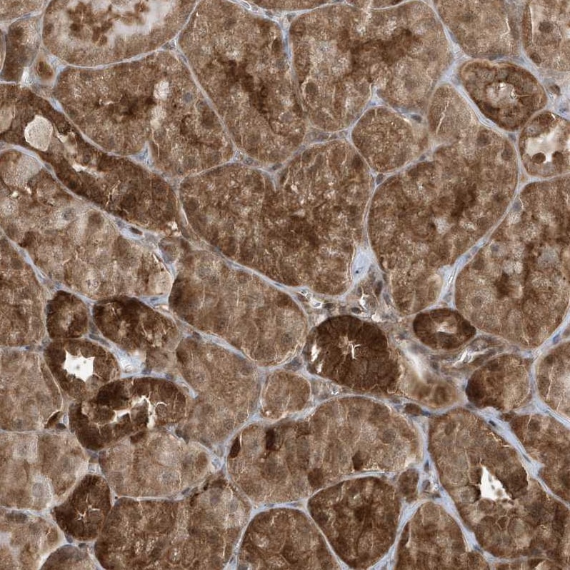 MAPK1IP1L Antibody - BSA Free Immunohistochemistry-Paraffin: MAPK1IP1L Antibody - BSA Free [NBP1-88420]