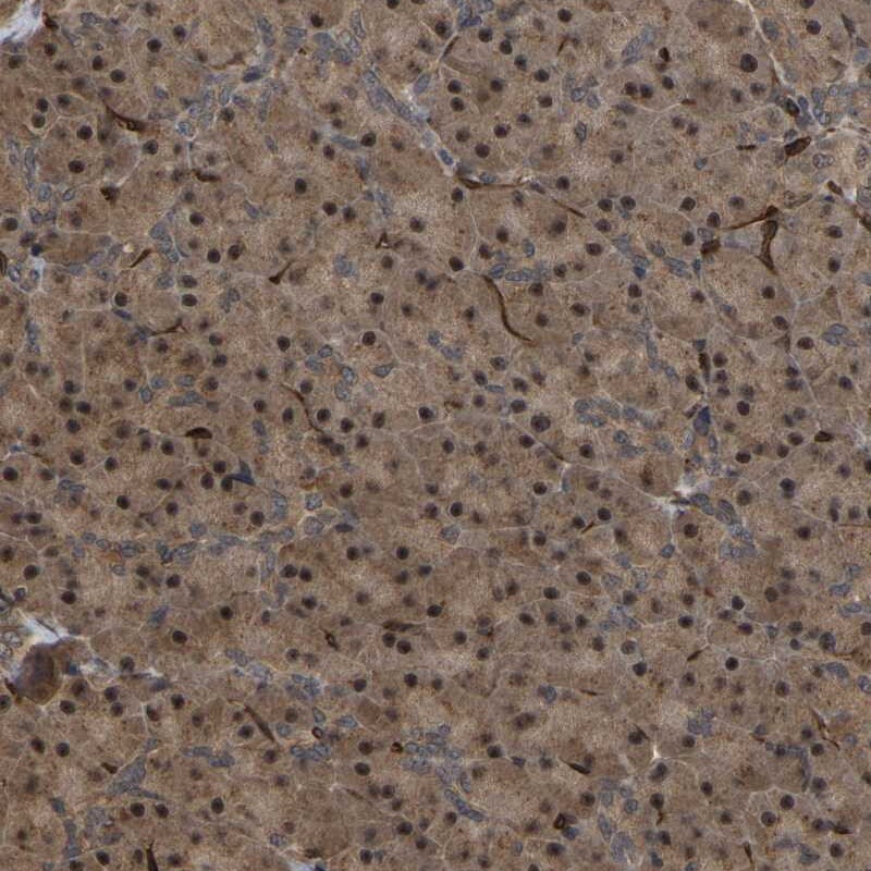FAM161B Antibody - BSA Free Immunohistochemistry-Paraffin: FAM161B Antibody - BSA Free [NBP1-88421]