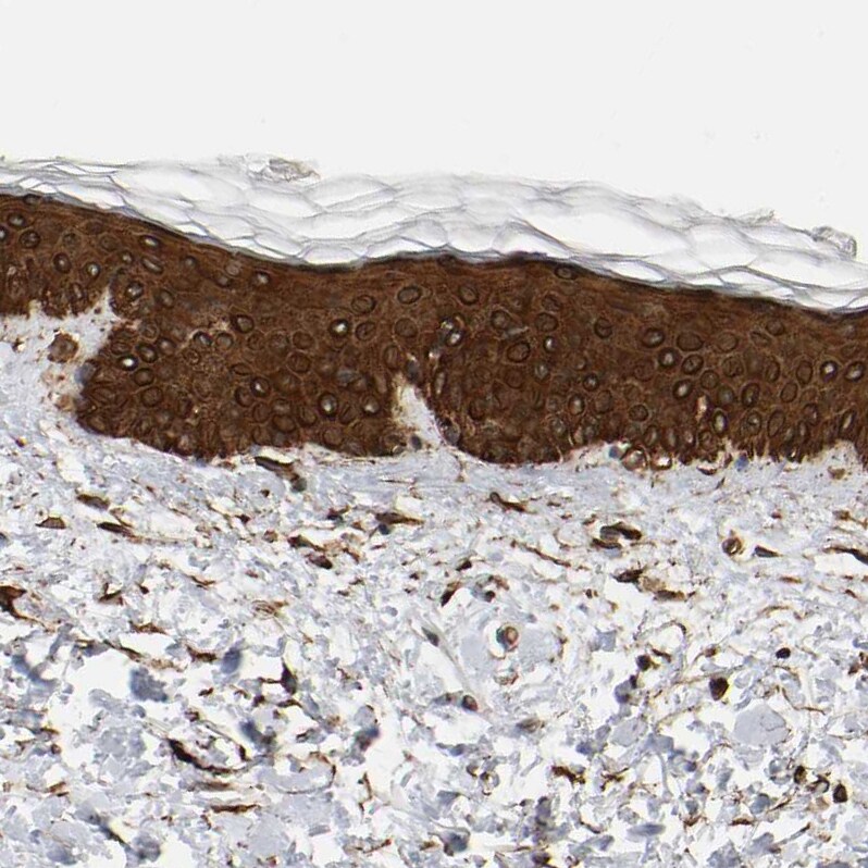 AHNAK2 Antibody - BSA Free Immunohistochemistry-Paraffin: AHNAK2 Antibody - BSA Free [NBP1-88429]