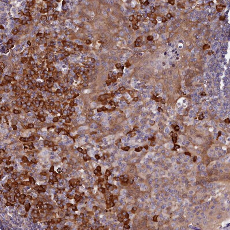 HN1L Antibody - BSA Free Immunohistochemistry-Paraffin: HN1L Antibody - BSA Free [NBP1-88445]