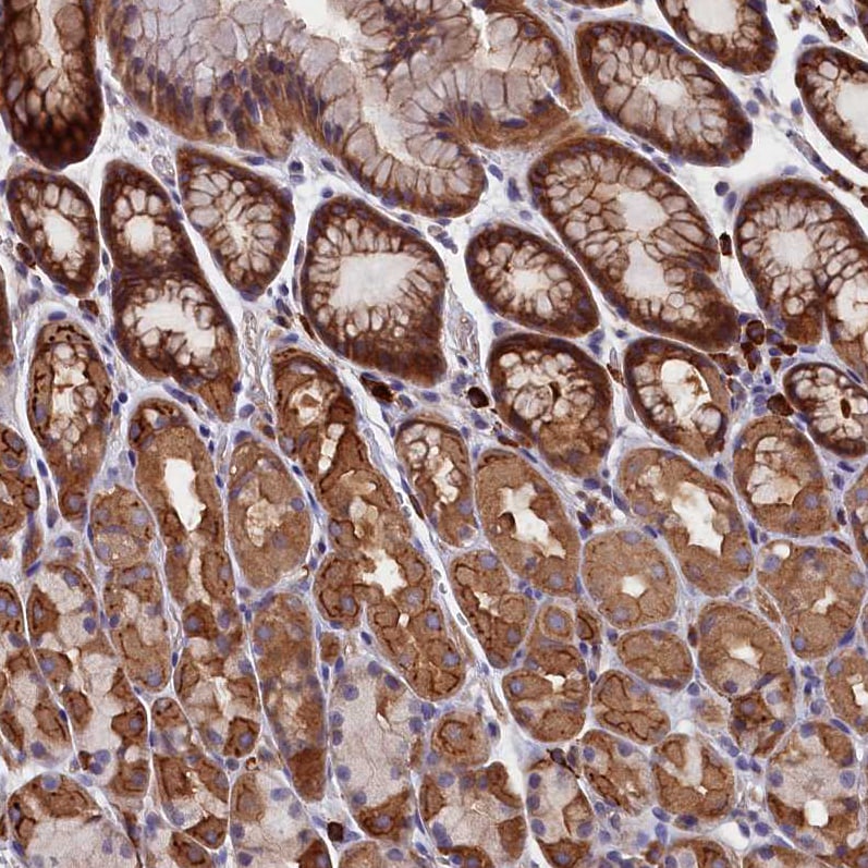 HN1L Antibody - BSA Free Immunohistochemistry-Paraffin: HN1L Antibody - BSA Free [NBP1-88445]