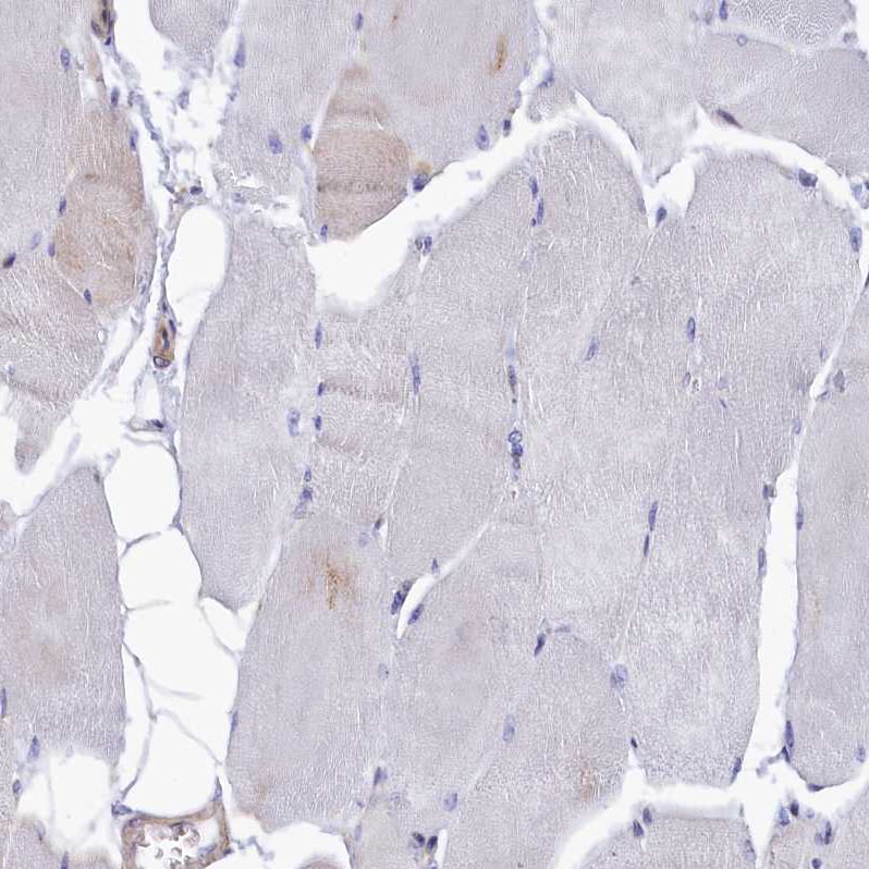 HN1L Antibody - BSA Free Immunohistochemistry-Paraffin: HN1L Antibody - BSA Free [NBP1-88445]