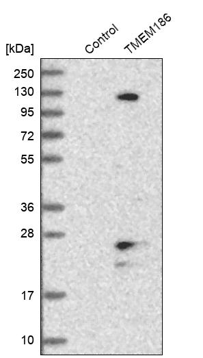 TMEM186 Antibody - BSA Free Western Blot: TMEM186 Antibody - BSA Free [NBP1-88452]