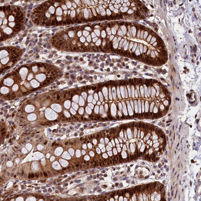 LIN10 Antibody - BSA Free Immunohistochemistry-Paraffin: LIN10 Antibody [NBP1-88454]