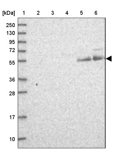 LIN10 Antibody - BSA Free Western Blot: LIN10 Antibody - BSA Free [NBP1-88454]