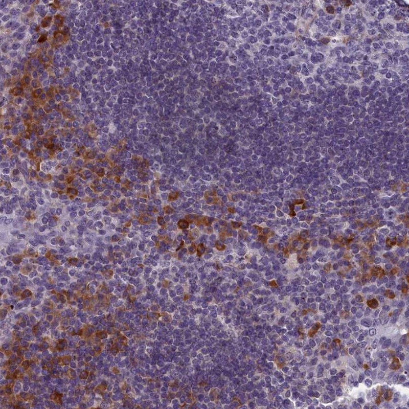 TMEM188 Antibody - BSA Free Immunohistochemistry-Paraffin: TMEM188 Antibody - BSA Free [NBP1-88455]