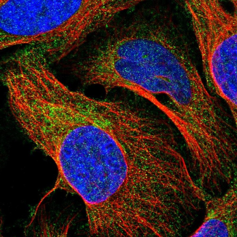 CTU2 Antibody - BSA Free Immunocytochemistry/ Immunofluorescence: CTU2 Antibody - BSA Free [NBP1-88457]