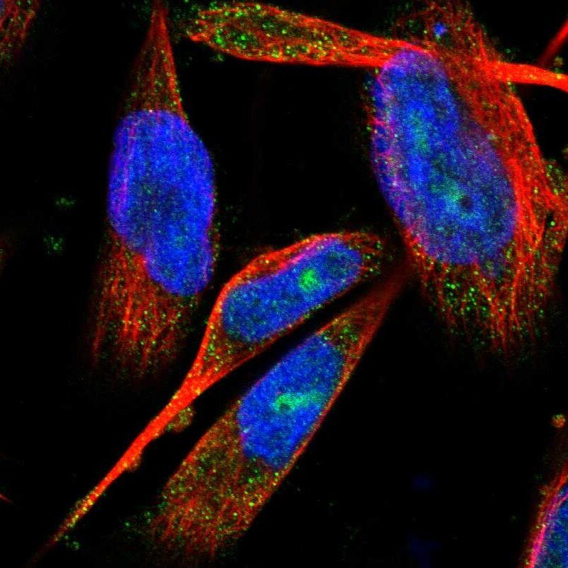 GLOD4 Antibody - BSA Free Immunocytochemistry/ Immunofluorescence: GLOD4 Antibody [NBP1-88464]