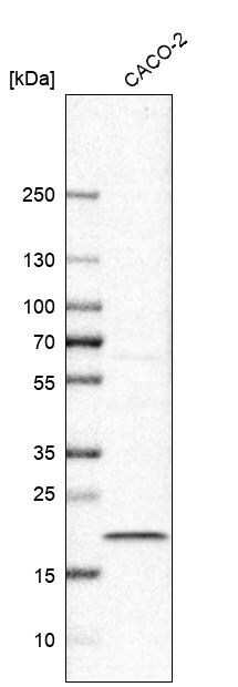 TMEM199 Antibody - BSA Free Western Blot: TMEM199 Antibody - BSA Free [NBP1-88467]
