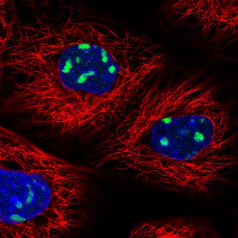 UTP6 Antibody - BSA Free Immunocytochemistry/ Immunofluorescence: UTP6 Antibody [NBP1-88468]