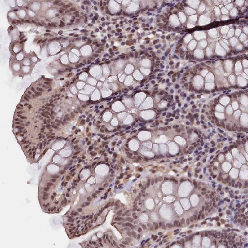 ZC3H4 Antibody - BSA Free Immunohistochemistry-Paraffin: ZC3H4 Antibody [NBP1-88474]
