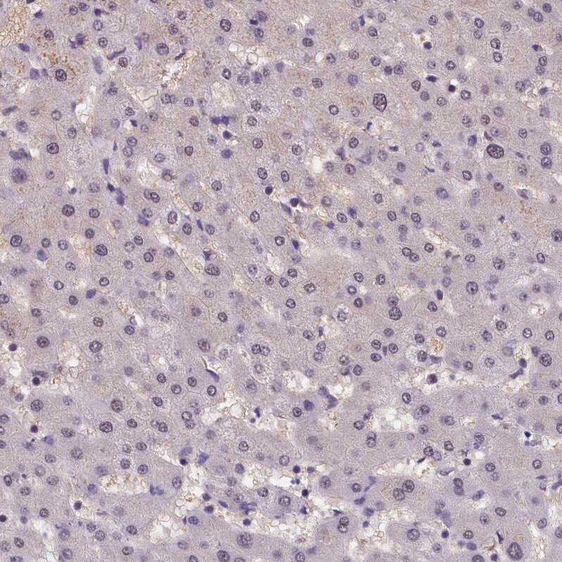 ZC3H4 Antibody - BSA Free Immunohistochemistry-Paraffin: ZC3H4 Antibody - BSA Free [NBP1-88475]