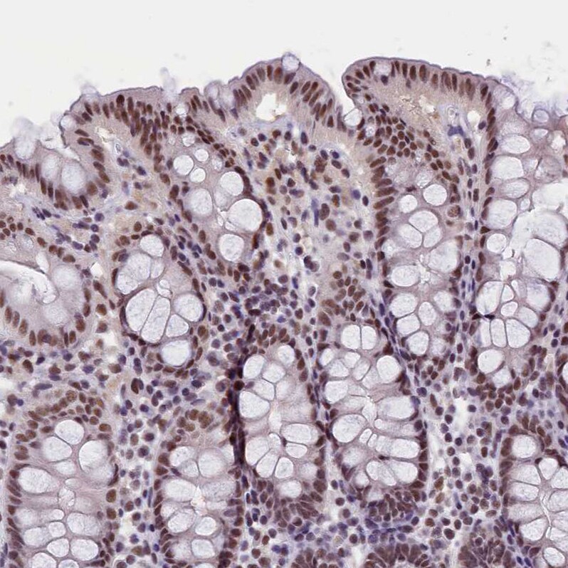 ZC3H4 Antibody - BSA Free Immunohistochemistry-Paraffin: ZC3H4 Antibody - BSA Free [NBP1-88475]