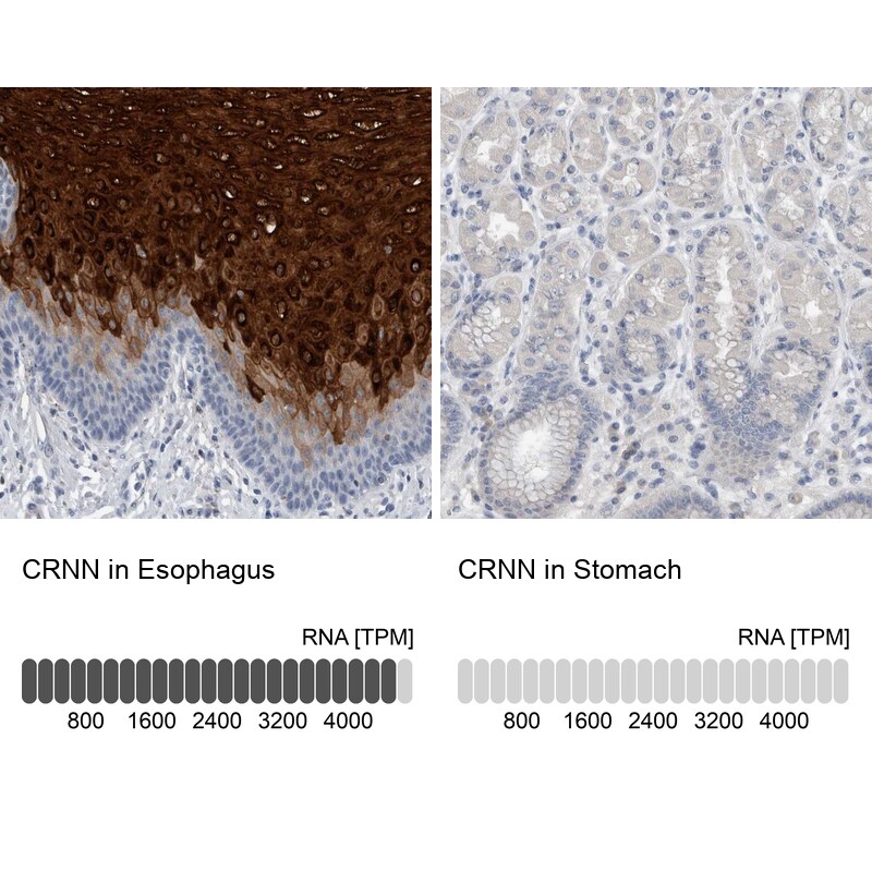 Cornulin Antibody - BSA Free Immunohistochemistry-Paraffin: Cornulin Antibody - BSA Free [NBP1-88479]