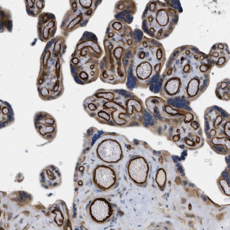 PALMD Antibody - BSA Free Immunohistochemistry-Paraffin: PALMD Antibody - BSA Free [NBP1-88481]
