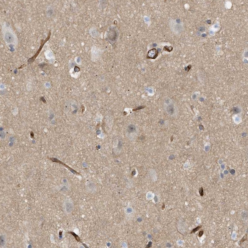 PALMD Antibody - BSA Free Immunohistochemistry-Paraffin: PALMD Antibody - BSA Free [NBP1-88481]