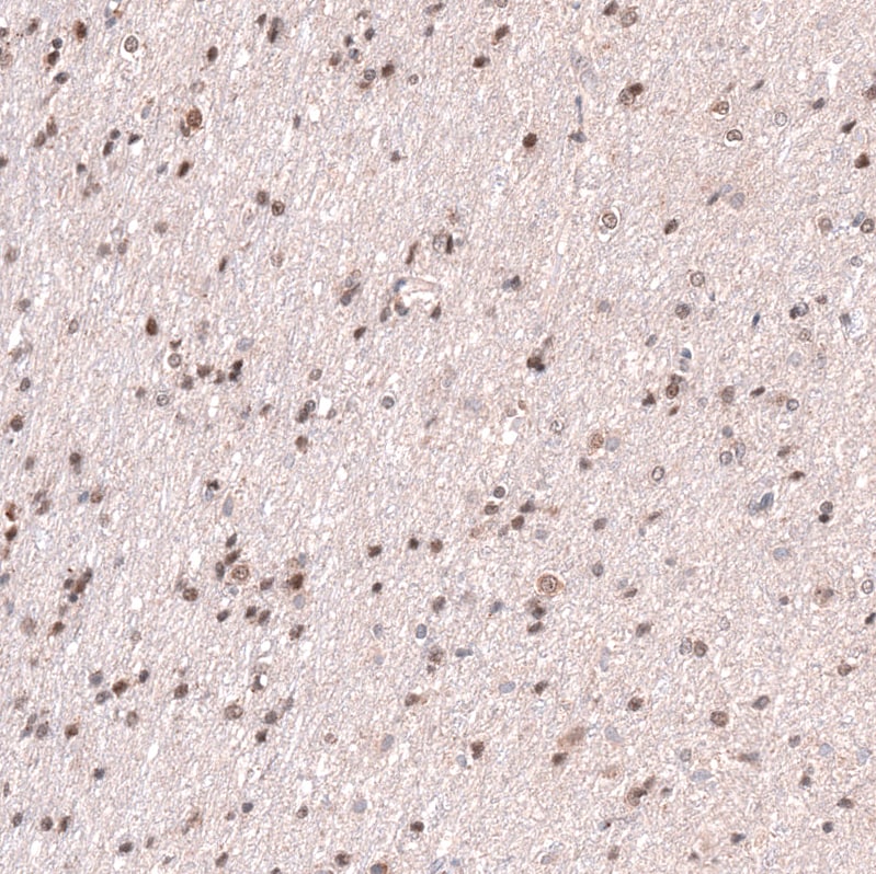 RNF220 Antibody - BSA Free Immunohistochemistry-Paraffin: RNF220 Antibody - BSA Free [NBP1-88487]