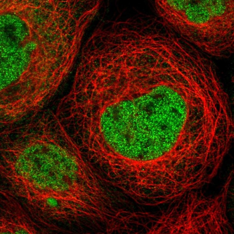 Mkl1 Antibody - BSA Free Immunocytochemistry/ Immunofluorescence: Mkl1 Antibody - BSA Free [NBP1-88498]
