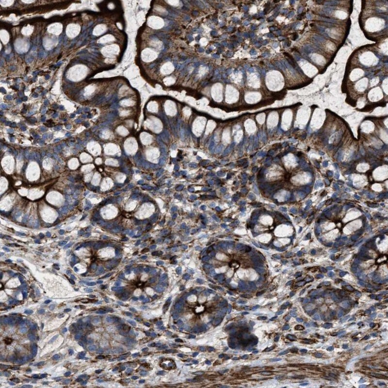 AGPAT2 Antibody - BSA Free Immunohistochemistry-Paraffin: AGPAT2 Antibody [NBP1-88499]