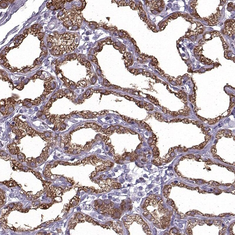 Carboxyl Ester Lipase/CEL Antibody - BSA Free Immunohistochemistry-Paraffin: Carboxyl Ester Lipase/CEL Antibody - BSA Free [NBP1-88502]