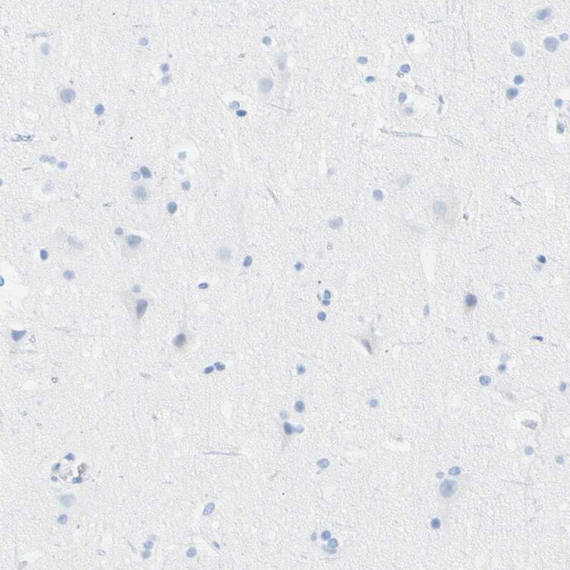 Carboxyl Ester Lipase/CEL Antibody - BSA Free Immunohistochemistry-Paraffin: Carboxyl Ester Lipase/CEL Antibody - BSA Free [NBP1-88502]