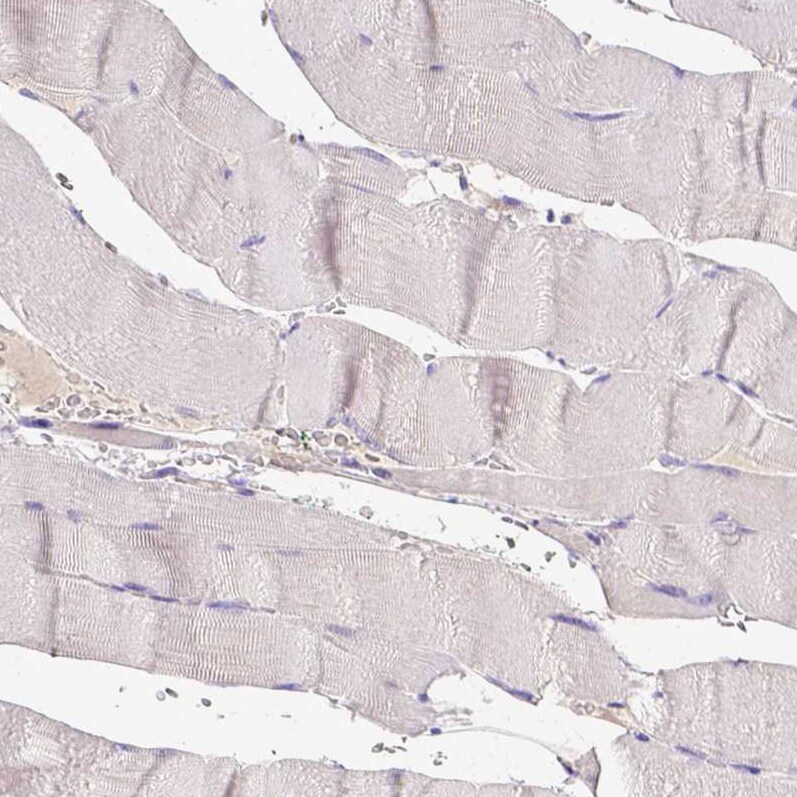 BTN1A1/Butyrophilin Antibody Immunohistochemistry-Paraffin: BTN1A1/Butyrophilin Antibody [NBP1-88503]