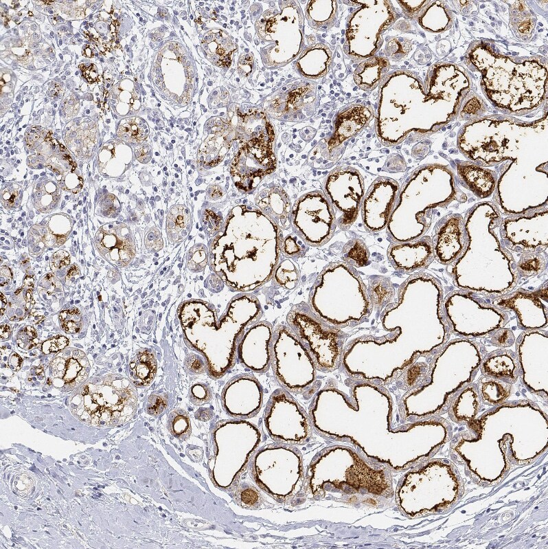 BTN1A1/Butyrophilin Antibody Immunohistochemistry-Paraffin: NMES1 Antibody [NBP1-88503]