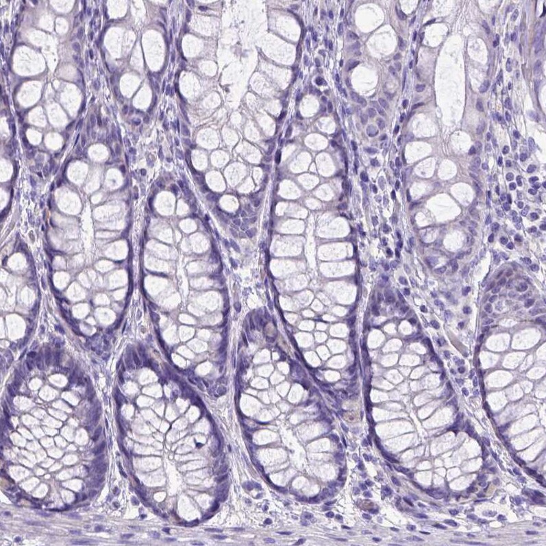 BTN1A1/Butyrophilin Antibody Immunohistochemistry-Paraffin: BTN1A1/Butyrophilin Antibody [NBP1-88503]