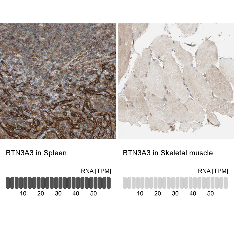 BTN3A3 Antibody - BSA Free Immunohistochemistry-Paraffin: BTN3A3 Antibody [NBP1-88509]
