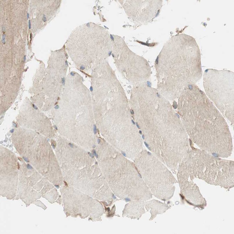 BTN3A3 Antibody - BSA Free Immunohistochemistry-Paraffin: BTN3A3 Antibody [NBP1-88509]