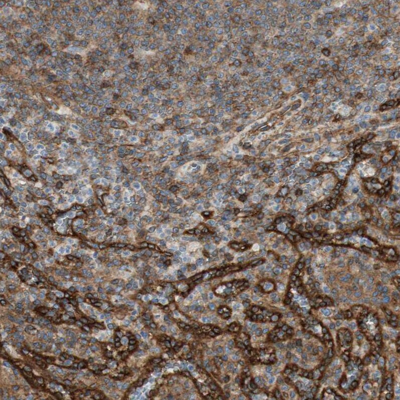 BTN3A3 Antibody - BSA Free Immunohistochemistry-Paraffin: BTN3A3 Antibody [NBP1-88509]