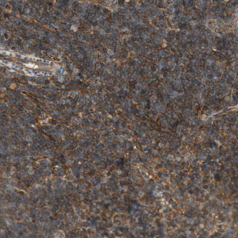 BTN3A3 Antibody - BSA Free Immunohistochemistry-Paraffin: BTN3A3 Antibody [NBP1-88509]