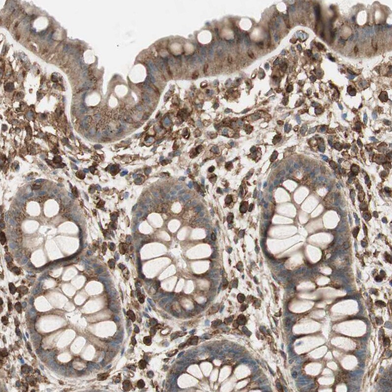 BTN3A3 Antibody - BSA Free Immunohistochemistry-Paraffin: BTN3A3 Antibody [NBP1-88509]