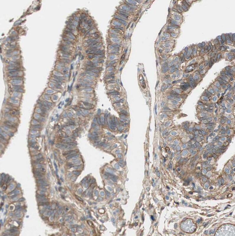 BTN3A3 Antibody - BSA Free Immunohistochemistry-Paraffin: BTN3A3 Antibody [NBP1-88509]