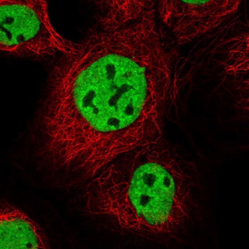 IBTK Antibody - BSA Free Immunocytochemistry/ Immunofluorescence: IBTK Antibody [NBP1-88512]