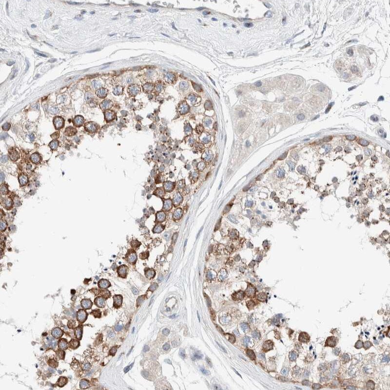 CASC3 Antibody - BSA Free Immunohistochemistry: CASC3 Antibody - BSA Free [NBP1-88515]