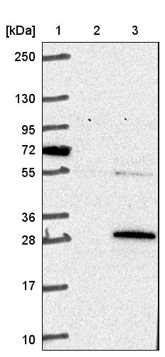COMMD3 Antibody - BSA Free Western Blot: COMMD3 Antibody - BSA Free [NBP1-88519]