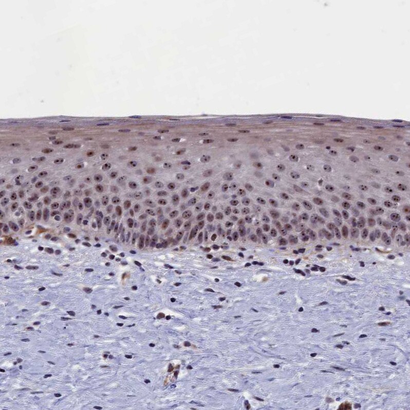 PPAN Antibody - BSA Free Immunohistochemistry-Paraffin: PPAN Antibody - BSA Free [NBP1-88525]