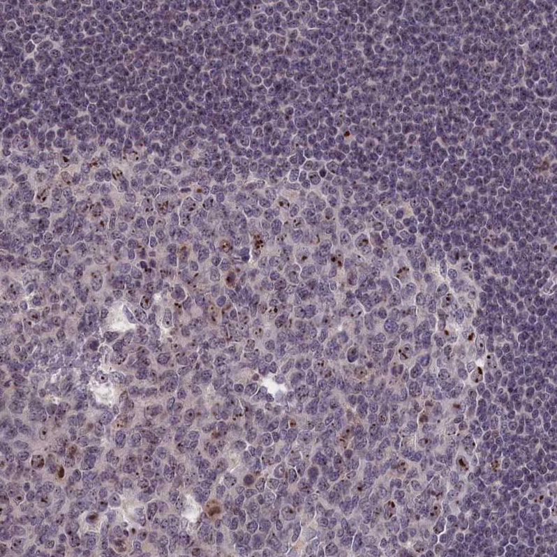 PPAN Antibody - BSA Free Immunohistochemistry-Paraffin: PPAN Antibody - BSA Free [NBP1-88525]