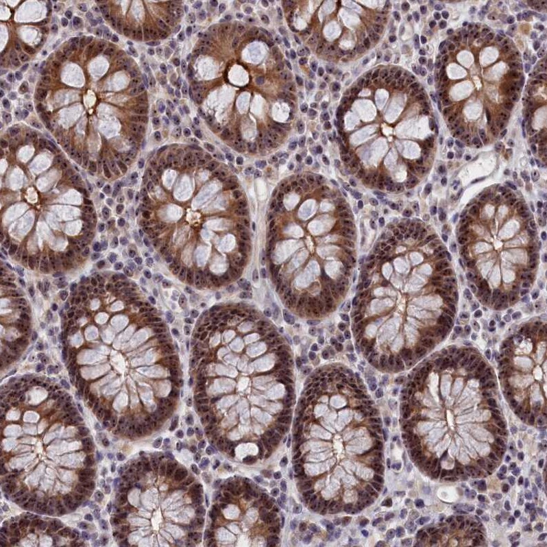 PPAN Antibody - BSA Free Immunohistochemistry-Paraffin: PPAN Antibody - BSA Free [NBP1-88525]