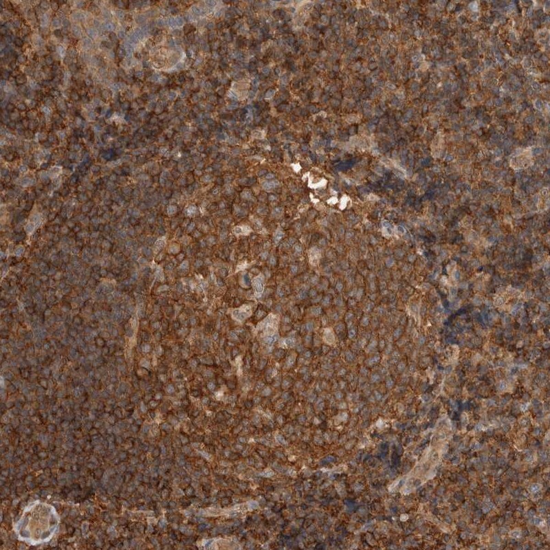 PFDN4 Antibody - BSA Free Immunohistochemistry-Paraffin: PFDN4 Antibody [NBP1-88526]