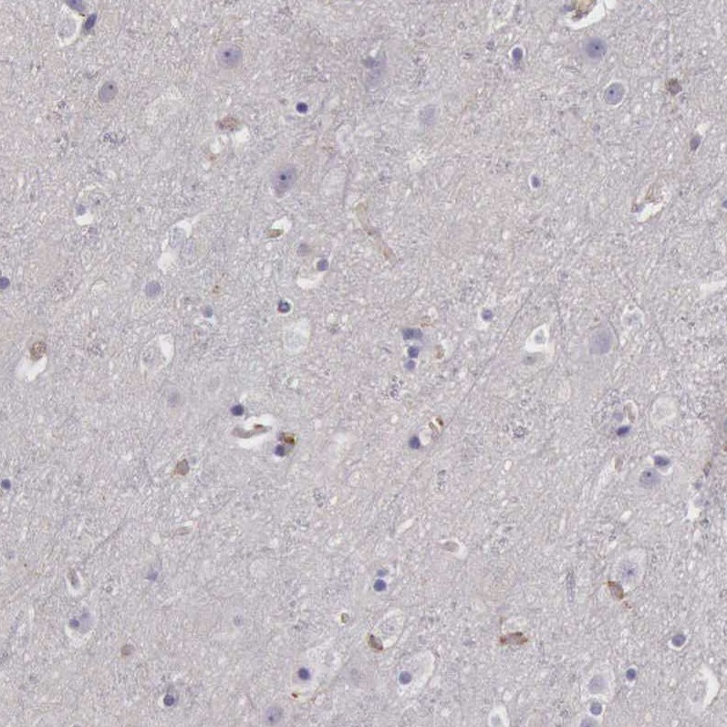 ARHGAP4 Antibody - BSA Free Immunohistochemistry-Paraffin: ARHGAP4 Antibody - BSA Free [NBP1-88527]