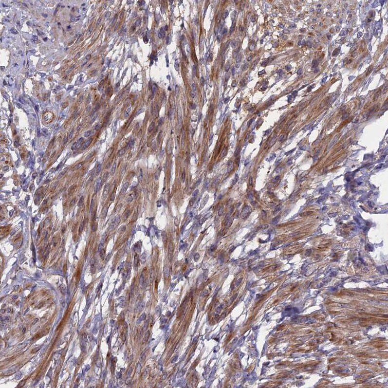 ADO Antibody - BSA Free Immunohistochemistry-Paraffin: ADO Antibody - BSA Free [NBP1-88530]