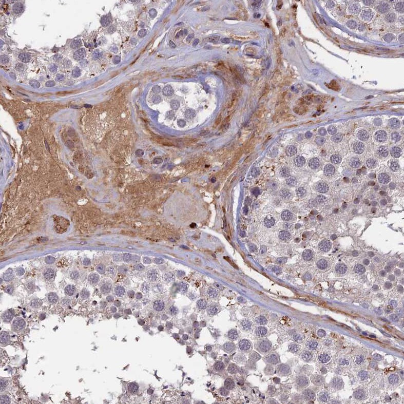 ADO Antibody - BSA Free Immunohistochemistry-Paraffin: ADO Antibody - BSA Free [NBP1-88530]