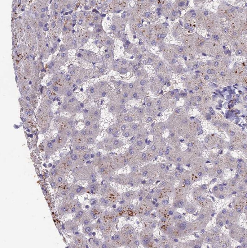 ADO Antibody - BSA Free Immunohistochemistry-Paraffin: ADO Antibody - BSA Free [NBP1-88530]