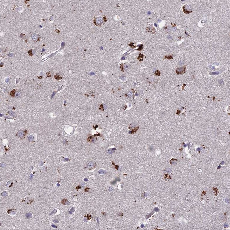 ADO Antibody - BSA Free Immunohistochemistry-Paraffin: ADO Antibody - BSA Free [NBP1-88530]