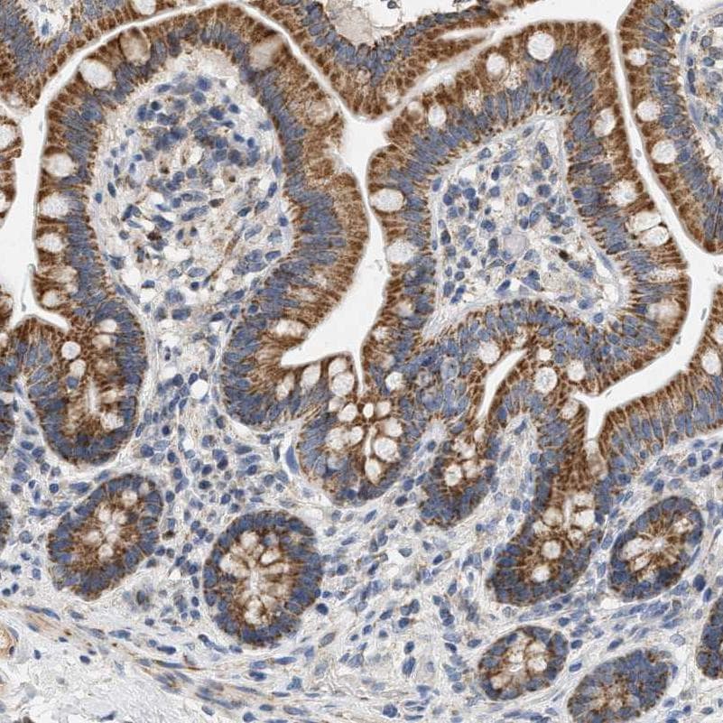 CCDC109A Antibody Immunohistochemistry-Paraffin: CCDC109A Antibody [NBP1-88534]